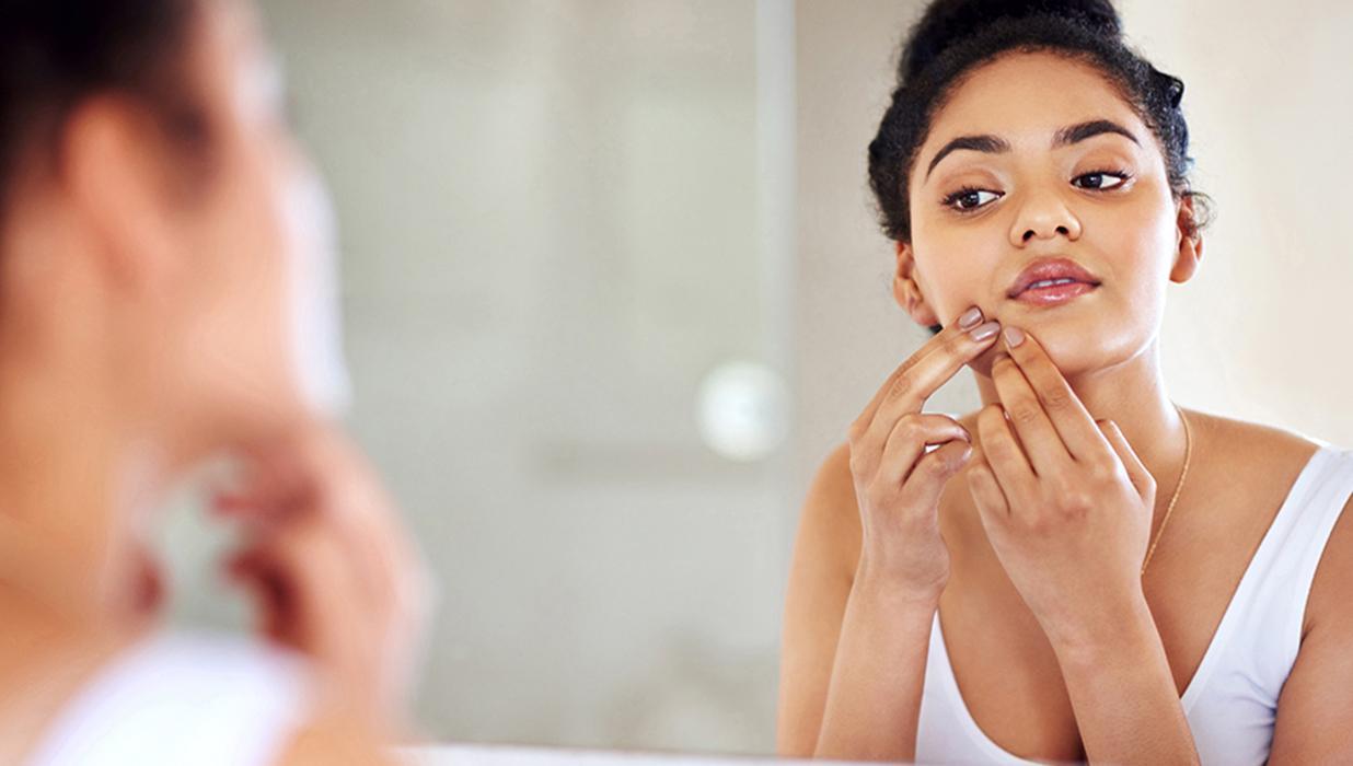 Understanding Acne: Skin Health Basics